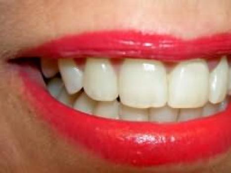 К чему снится выпадение трех зубов